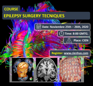 Técnicas de Cirugía de la Epilepsia